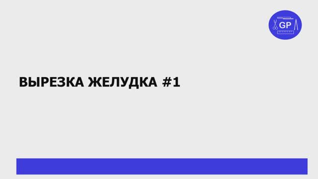 Рак желудка - гистологическое исследование #1