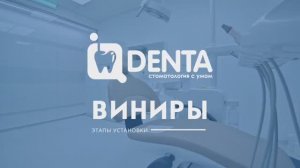 Что такое виниры? Объясняем просто и доступно.