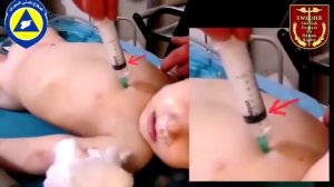 "White helmets" kills baby making fake "life-saving" video (18+)