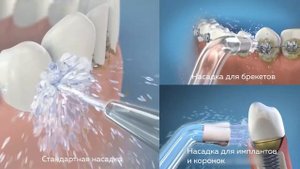 Как пользоваться портативным ирригатором Waterpik WP-563 Blue
