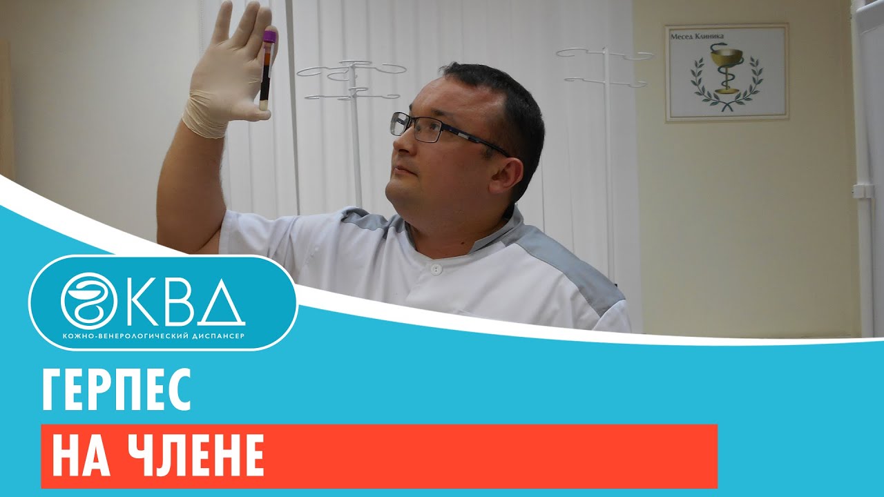 Герпес на члене. Клинический случай №31