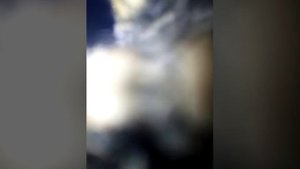 Нападение бешеной лисы