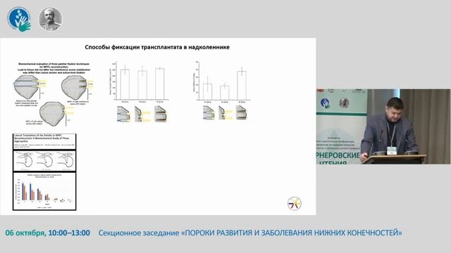 Дислокация надколенника у детей и подростков. Пути решения проблемы. смотреть онлайн