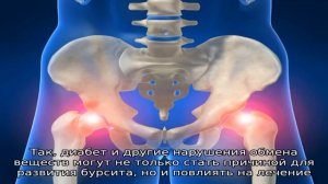 Бурсит тазобедренного сустава