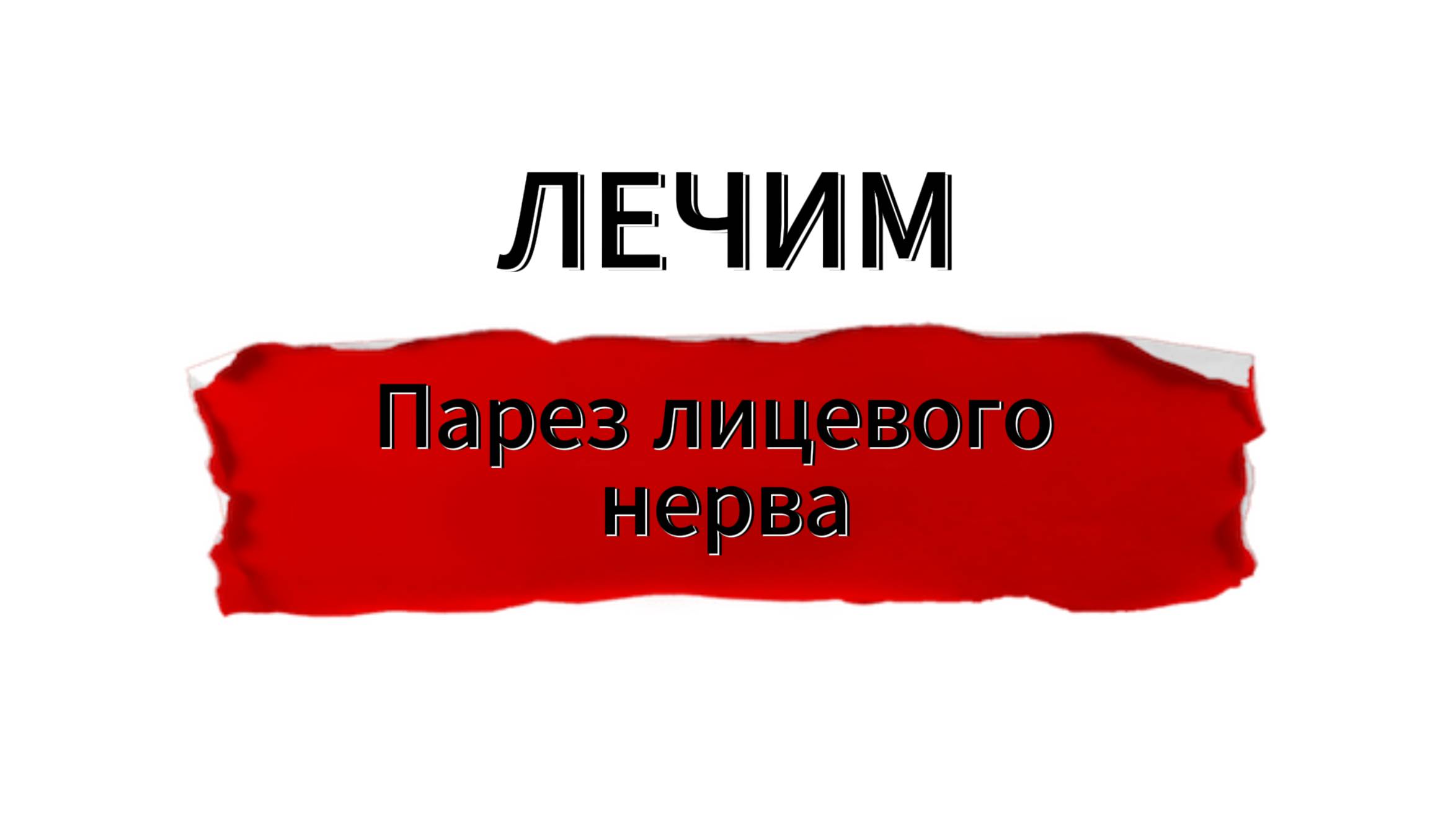 Лечение пареза лицевого нерва