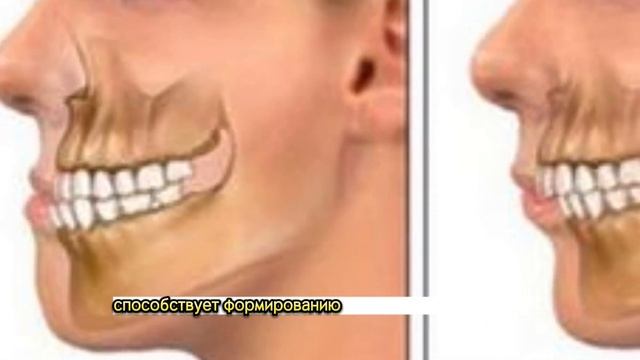 ВОТ КАК ПРАВИЛЬНО СПАТЬ И ВСЕ БОЛЕЗНИ УЙДУТ #какправильноспать  #позыдлясна