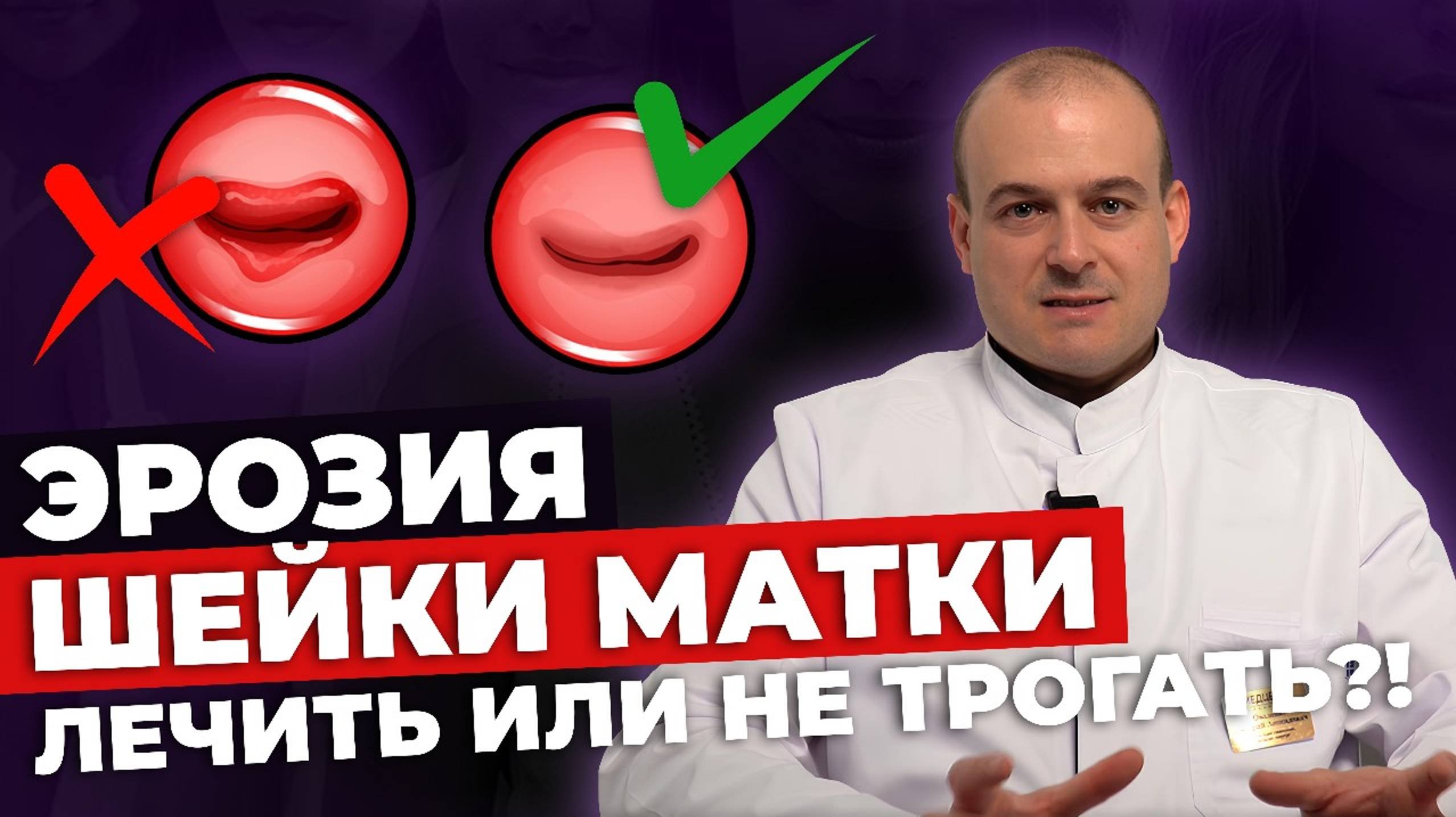 ЭРОЗИЯ ШЕЙКИ МАТКИ | ПРИЖИГАНИЕ ЭРОЗИИ НЕОБХОДИМО?
