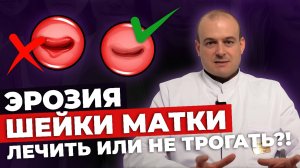 ЭРОЗИЯ ШЕЙКИ МАТКИ | ПРИЖИГАНИЕ ЭРОЗИИ НЕОБХОДИМО?