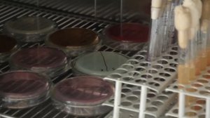 Сальмонелла, кишечная палочка и стафилококк в мясе и молоке