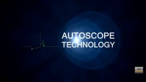 TPS Sensor -диагностика датчика TPS