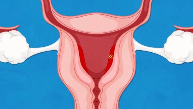 How does mifepristone work?