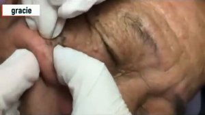 Человек не ухаживал за лицом 40 лет!