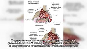 Причины появления крови из носа при сморкании