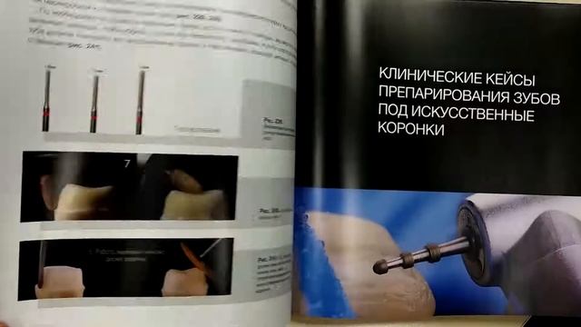 Эстетика керамических реставраций