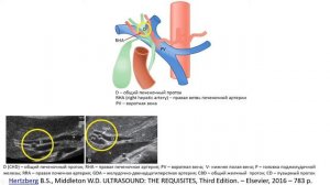 Клиническая и ультразвуковая анатомия желчного пузыря и желчевыводящих путей