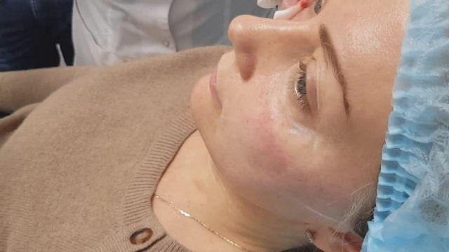 Обучение косметологов , мастер-класс проводит Врач дерматолог - косметолог Хуснутдинова Н.В.