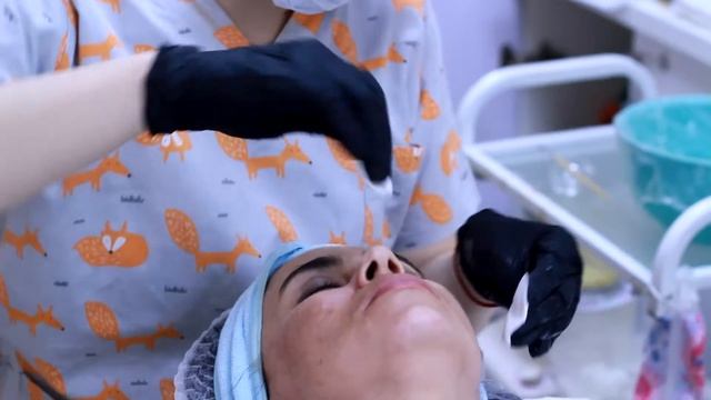 Миндальный пилинг смотреть онлайн