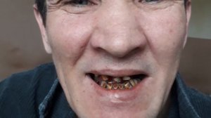 Берегите зубы, зубы берегите! ))