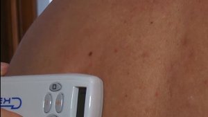 Работа с аппаратом ЧЭНС 01 СКЭНАР М в индивидуально дозированном режиме
