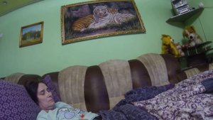СТОМА ПОСЛЕ ДТП, С ОСЛОЖНЕНИЯМИ.STOMA AFTER ACCIDENT, WITH COMPLICATIONS.