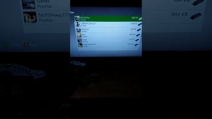 HOW TO FIX XBOX LIVE ACCOUNT ERROR 80151103 | Xbox 360