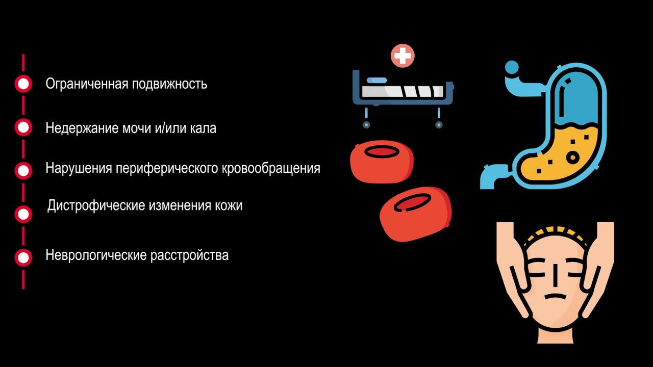 Меры по профилактике возникновения пролежней смотреть онлайн