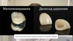 коронки