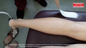 Тейпирование ахиллова сухожилия | Taping guide for Achilles Tendonitis