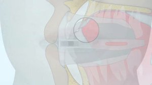 Капы от храпа Myosa