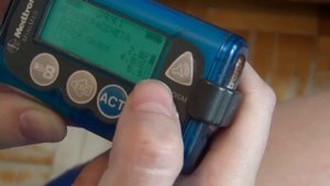 Квадратный болюс на инсулиновой помпе