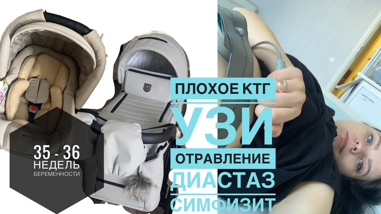 Купили коляску 35 - 36 недель беременности • Отравление • Симфизит • Диастаз • Плохое КТГ • УЗИ
