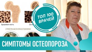 Симптомы Остеопороза костей. Как определить остеопороз, диагностика у женщин и мужчин