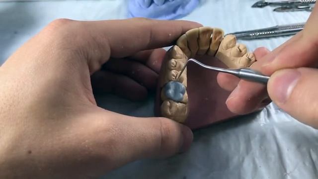 Моделирование моляра из воска. waxup molar