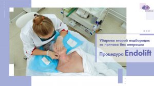 Endolift. Безоперационная подтяжка лица. Проведение процедуры