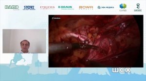 А. Аболмасов E-TEP пластика при паховой грыже