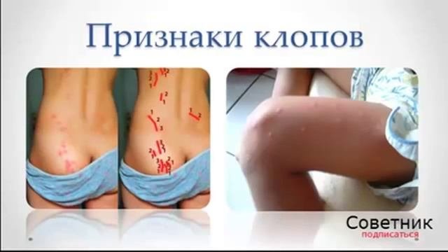 Все о клопах