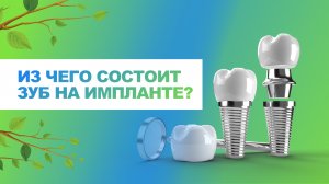 ? Из чего состоит зуб на импланте (имплант+абатмент+коронка)