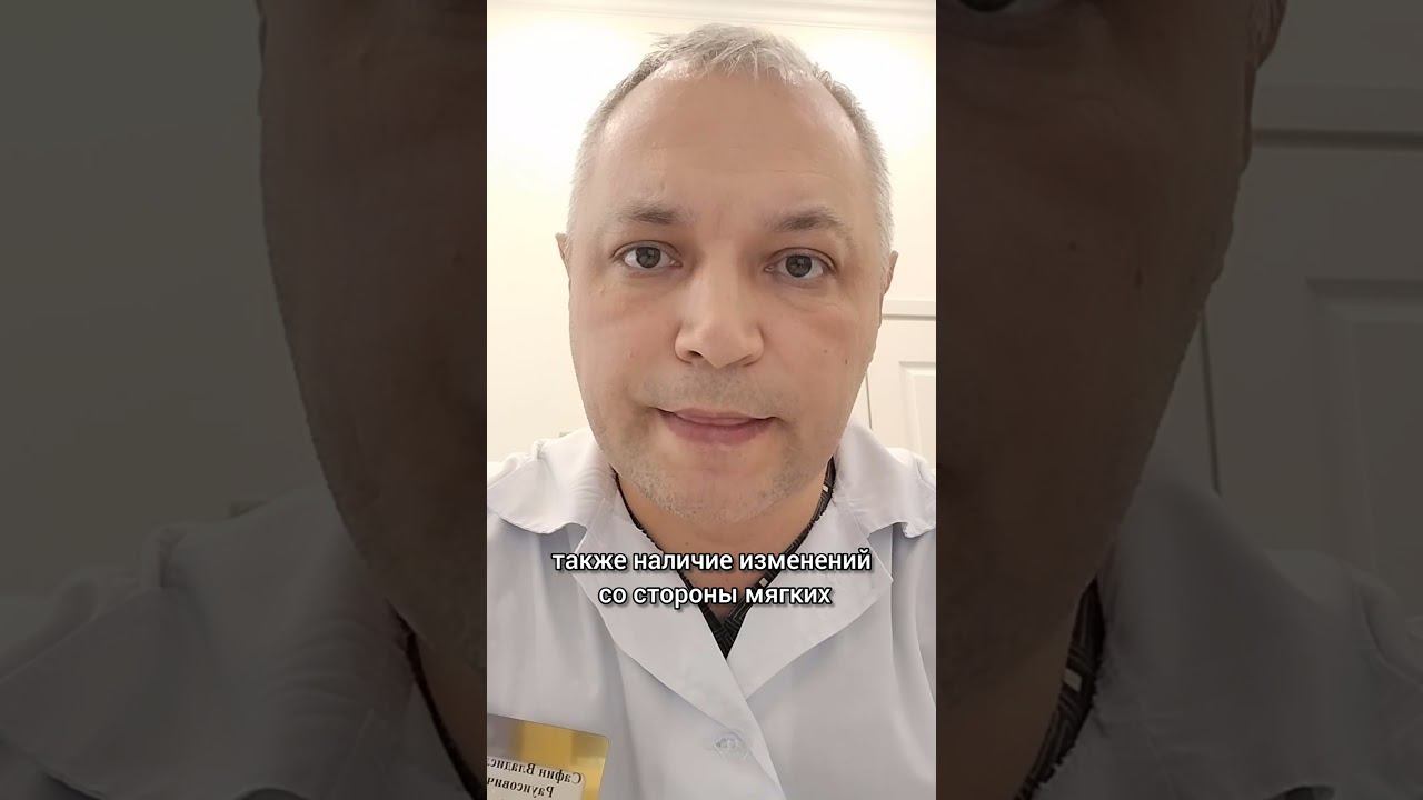 ПРАВИЛЬНЫЙ ПОДХОД К СУСТАВАМ