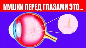 Мушки в глазах как избавиться. Перед глазами плавают нити.mp4