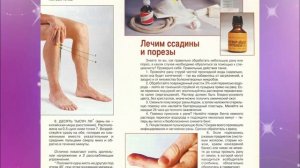 Как правильно обрабатывать раны аптечными средствами в домашних условиях. Лечение ссадин и порезов