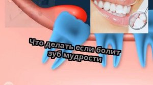 Что делать если болит зуб мудрости