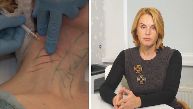 Професор Яна Юцковська про методику Радієс у розведенні смотреть онлайн