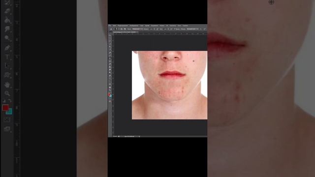 как убрать прыщи с помощью Фотошопа? как убрать прыщи // убираем прыщи в Фотошоп ! #short