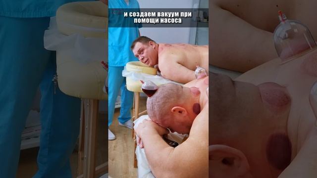 Хиджама на голову по этапно