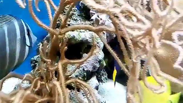 Мне сняли брекеты | НАКОНЕЦ-ТО смотреть онлайн