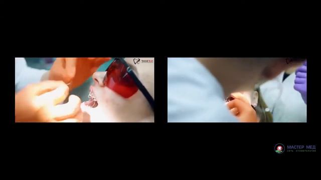 Что делать после снятия брекет-системы? Стоматолог-ортодонт Юлия Зданович смотреть онлайн