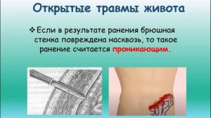 Первая помощь I ТРАВМЫ ЖИВОТА