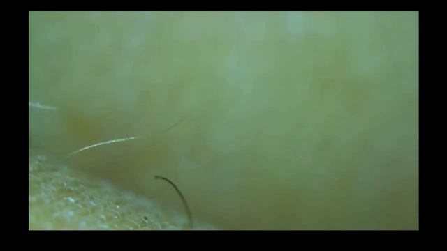 Tweezers & Treasures Live Stream смотреть онлайн