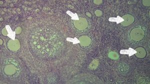 Разбор гистологического препарата: Яичник