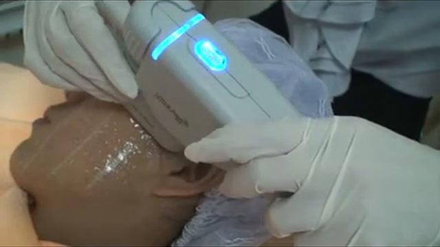 HIFU смотреть онлайн